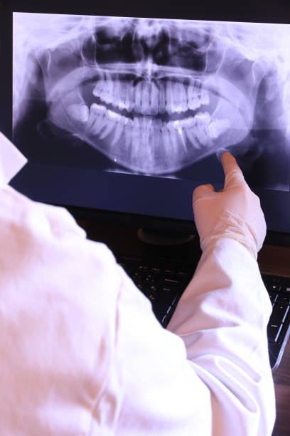 Best Broken or Cracked Tooth Emergency Dentist in Plano, IL
